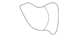 25330711 - : Part# 25330711 Strainer Kit for Buick: LeSabre, Park Avenue | Cadillac: DeVille, Eldorado, Seville | Oldsmobile: Aurora | Pontiac: Bonneville Image