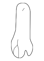 6808653 - HVAC: Actuator Rod for Volvo: C70, S70, V70 Image